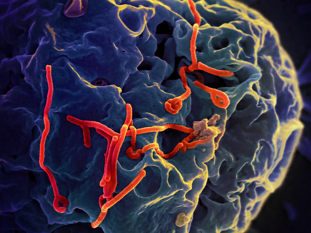 Ebola virus on a cell