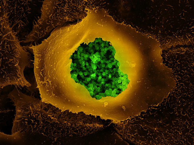 Chlamydia-infected human epithelial cell