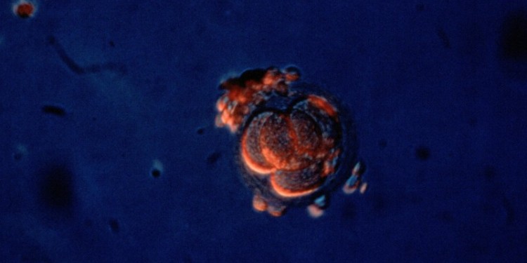 B0000348 Four-cell human embryo, light microscope