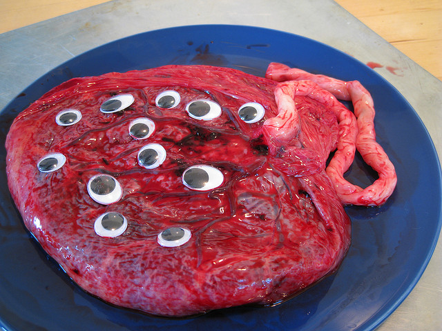 A placenta with googly eyes.