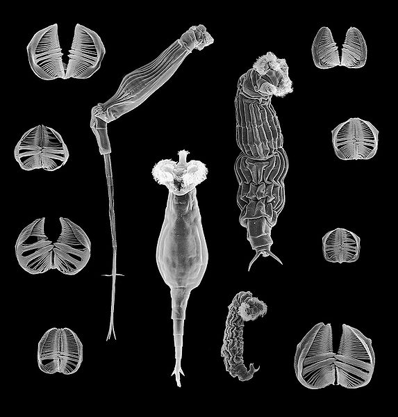 Scanning electron microscope image of rotifers